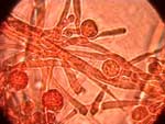 fungo-rosso-congo.jpg (8139 byte)