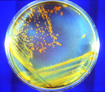 deinococcus radiodurans - Immagine tratta da science.nasa.gov/newhome/headlines/images/conan/D_rad_dish.jpg