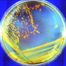 deinococcus radiodurans